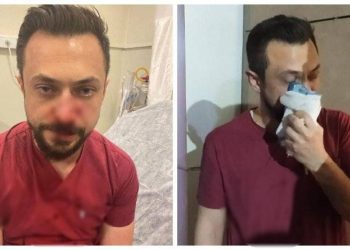 Urfa'da bir doktor, hasta yakının saldırısına uğradı