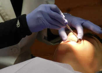 Uzmanlardan porselen diş uyarısı