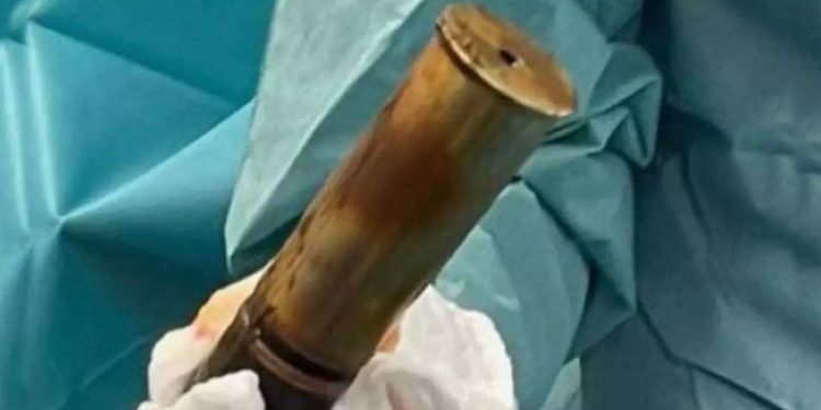 Anüsüne top mermisi sıkışan kişi acile gitti; hastane patlama riskine karşı tahliye edildi