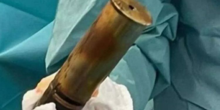 Anüsüne top mermisi sıkıştı, hastane patlama riskine karşı boşaltıldı!