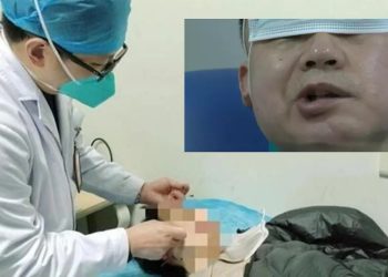 Dünya Kupası maçlarını takip etmek için uykusuz kaldı; yüz felci geçirdi