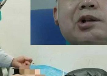 Dünya Kupası’nı izledi, felç oldu: Doktorlar sebebini açıkladı