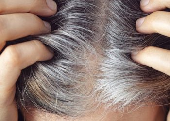 Erken yaşta saç beyazlaması nasıl önlenir? Saçlar kaç günde bir yıkanmalı?