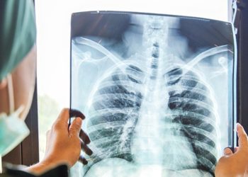 Göğüs Hastalıkları Uzmanı Özkaya: Pandeminin ilk zamanlarındaki akciğer vakaları yeniden gelmeye başladı