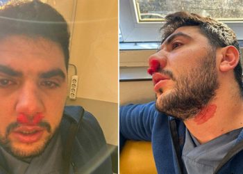 Hemşirenin burnunu kıran saldırgan tutuklandı