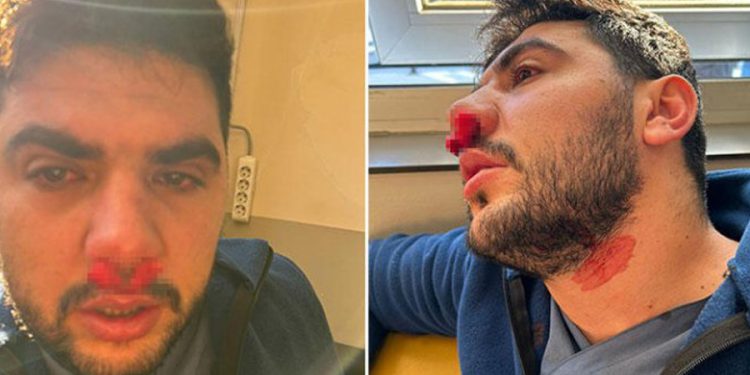 Hemşirenin burnunu kıran saldırgan tutuklandı