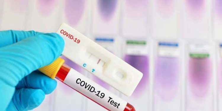 Hollanda, Çin'den gelen yolculara ücretsiz Covid-19 testi dağıtacak