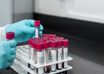 İngiltere'de altı çocuk S﻿trep A bakterisi nedeniyle öldü