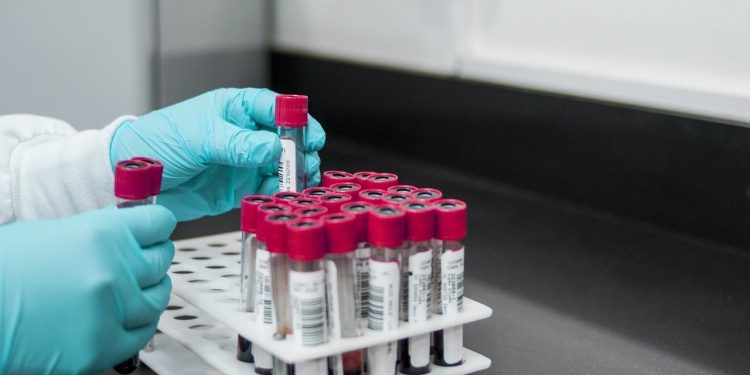 İngiltere'de altı çocuk S﻿trep A bakterisi nedeniyle öldü