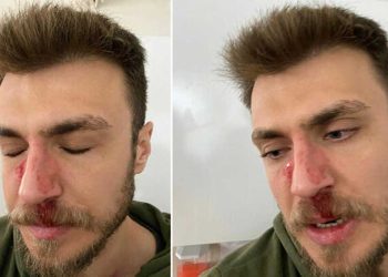İzmir'de hasta yakınınca darbedilen doktor kafa travması geçirmiş