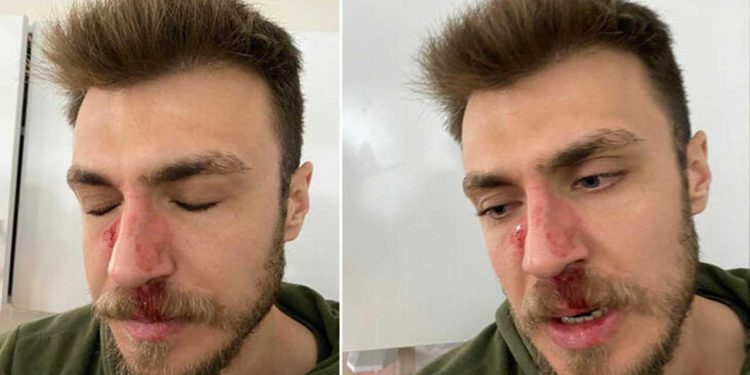 İzmir'de hasta yakınınca darbedilen doktor kafa travması geçirmiş