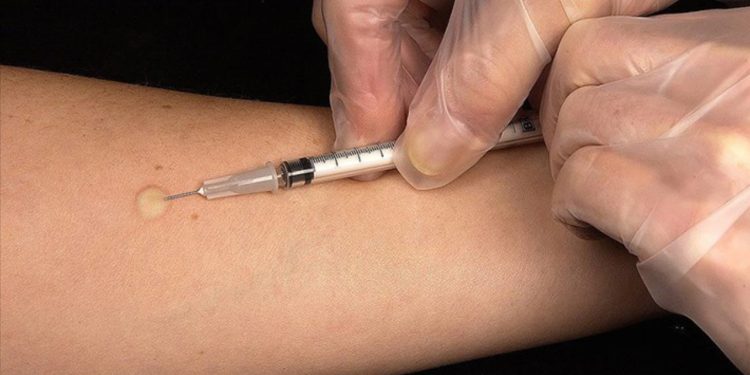 Kuduz aşısı bulunamıyor: "İkinci dozu olamadım, bekliyorum"