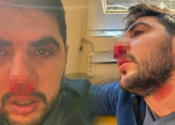 Sağlıkta şiddet durmuyor: İstanbul'da hasta yakını hemşireye yumruklu saldırıda bulundu
