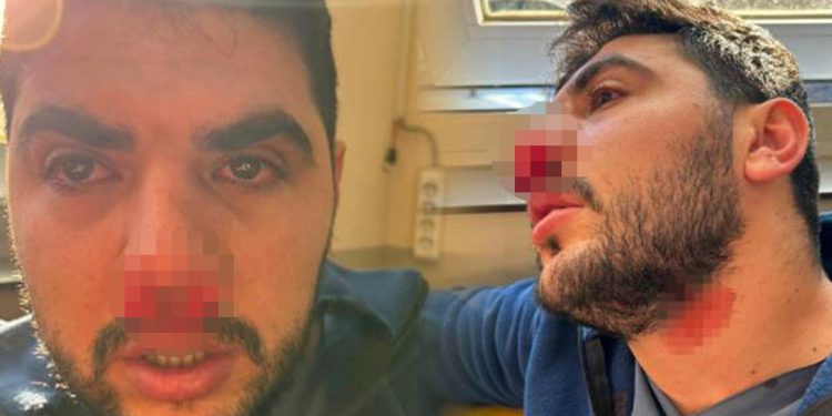 Sağlıkta şiddet durmuyor: İstanbul'da hasta yakını hemşireye yumruklu saldırıda bulundu