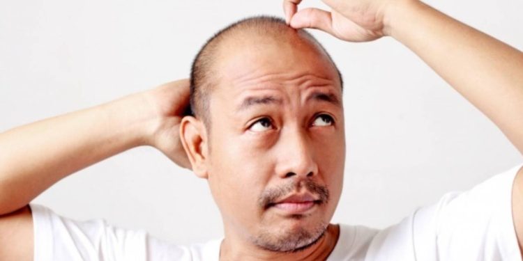 Uzmanından saç dökülmesine karşı 10 önlem