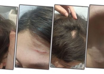 ÖGK üyesi Polat’a polis şiddeti