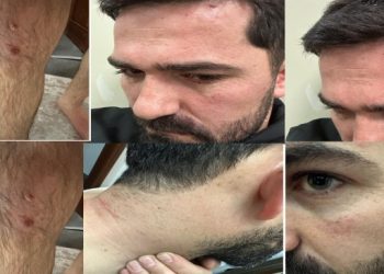 Polis kontrol noktasında avukata şiddet