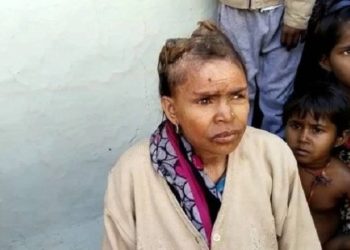 Hindistan'da bir kadının kafasında boynuzlar çıkıyor