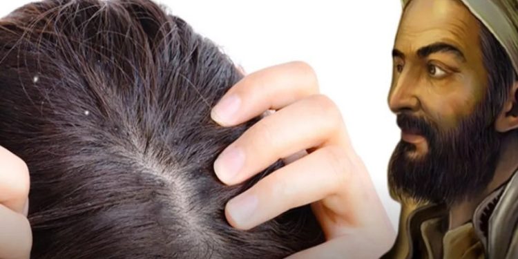 İbn-i Sina önermişti; Saçlardaki dökülmeyi önlüyor ve kepekleri yok ediyor
