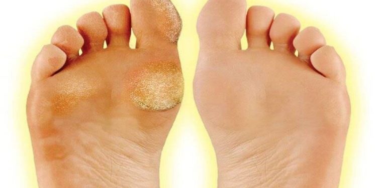 Nasır sorunu olanlar toplanın: İşte ayakta çıkan nasıra kalıcı çözüm