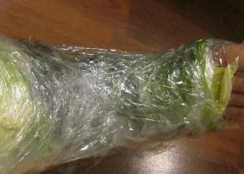 Lahana yapraklarının şaşırtan etkisi... Bu faydasını kimse duymamıştı