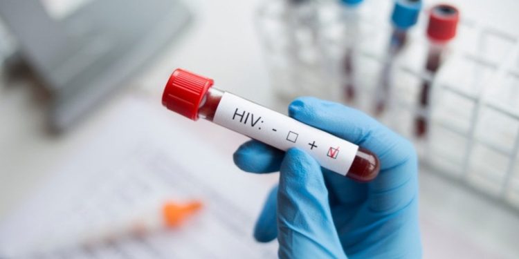 Prof. Dr. Şener: Tüm dünyada devam eden sessiz bir 'HIV pandemisi' var