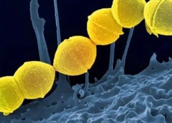 Strep A'dan ilk ölüm: Bakanlık sessiz, uzmanlar mevcut salgınların tehlikeyi artırdığını söylüyor