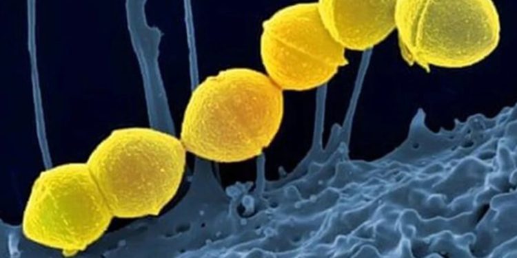 Strep A'dan ilk ölüm: Bakanlık sessiz, uzmanlar mevcut salgınların tehlikeyi artırdığını söylüyor