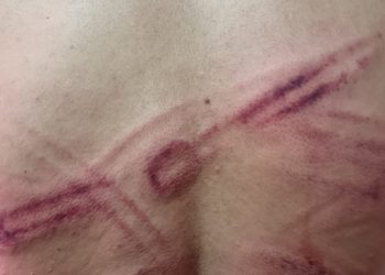 Hatay’da polislerden yurttaşa işkence