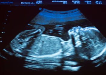 ABD'de avukat, 'hamile müvekkilinin doğmamış çocuğunun yasa dışı biçimde gözaltında tutulduğunu' iddia ederek serbest bırakılmasını istedi