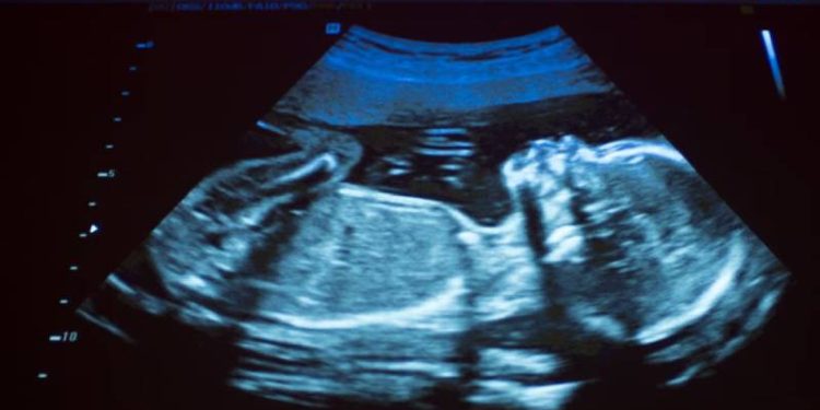 ABD'de avukat, 'hamile müvekkilinin doğmamış çocuğunun yasa dışı biçimde gözaltında tutulduğunu' iddia ederek serbest bırakılmasını istedi