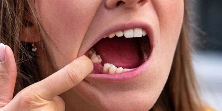 Dişleri nedeniyle işe başladığı gün kovuldu