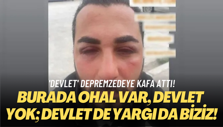 ‘Devlet’ depremzedeye kafa attı! Burada OHAL var, devlet yok, devlet de yargı da biziz!