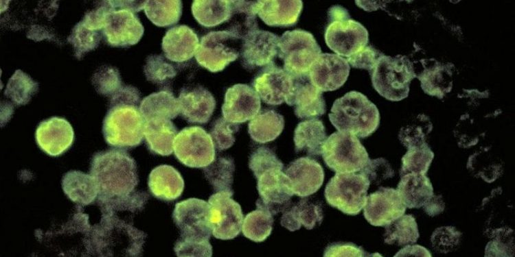 ABD’nin Florida eyaletinde bir kişi, beyin yiyen amip nedeniyle hayatını kaybetti. Ölen kişinin kimliği açıklanmadı.