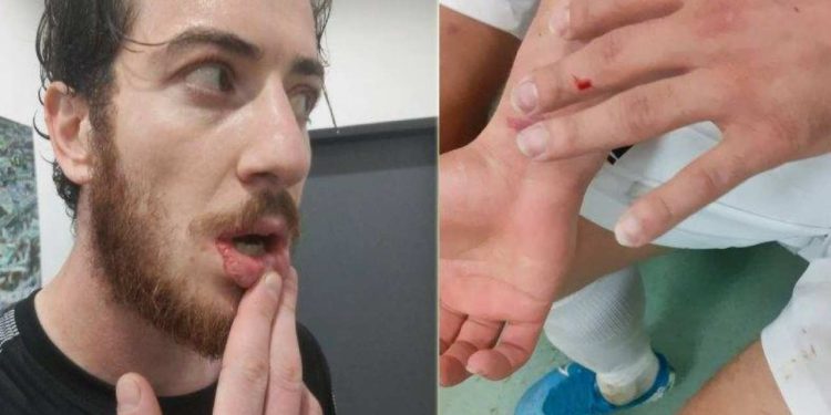 Amedspor kalecisi Cantuğ Temel: O kadar cisim atıldı ama Türkiye haritalı olan, bir polis çocuğu olarak beni çok yaraladı