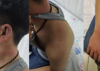Avukat anlattı: Lice'de 14 yaşındaki Y.D.'ye işkence edip bataklığa attılar