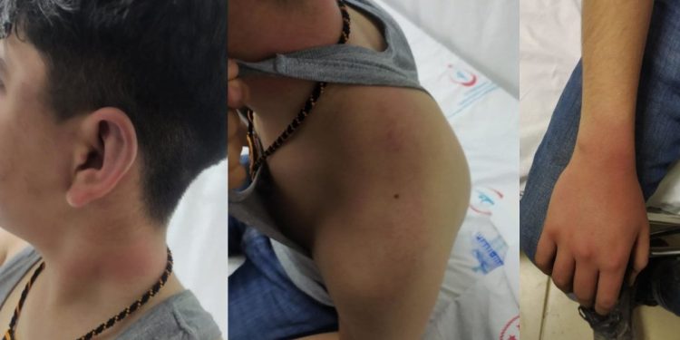 Avukat anlattı: Lice'de 14 yaşındaki Y.D.'ye işkence edip bataklığa attılar