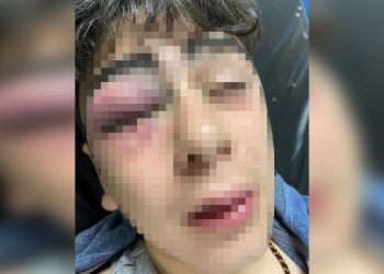 Diyarbakır’da 14 yaşındaki çocuğa işkence eden 3 polise gözaltı