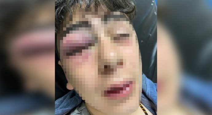 Diyarbakır’da 14 yaşındaki çocuğa işkence eden 3 polise gözaltı