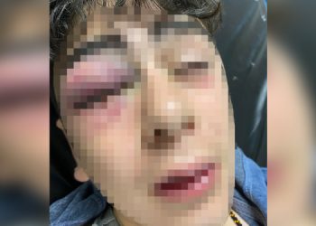 Diyarbakır’da 14 yaşındaki gence şiddet uygulayan 5 polis tutuklandı