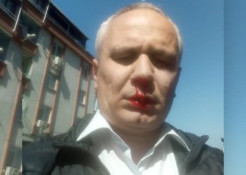 İlahiyatçı yazar Cemil Kılıç, evinin önünde darp edildi: Allahu Ekber deyip saldırdılar