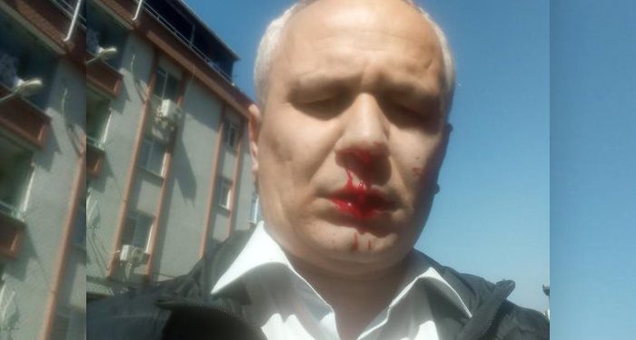 İlahiyatçı yazar Cemil Kılıç, evinin önünde darp edildi: Allahu Ekber deyip saldırdılar