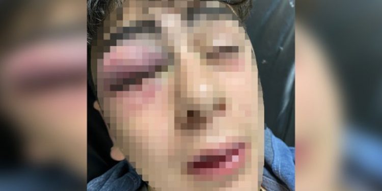 Lice’de 14 yaşındaki çocuğa işkence yapan 5 polisten 3’ü tutuklandı