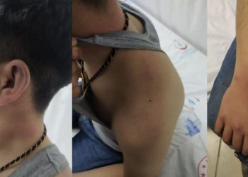 Lice’de polis işkencesine maruz kalan 14 yaşındaki çocuğun ifadesi ortaya çıktı