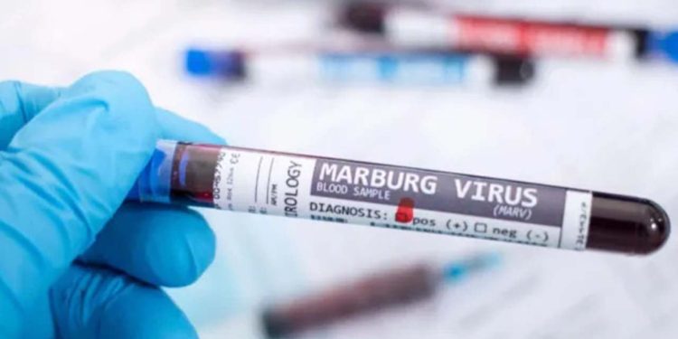 Marburg salgını Tanzanya'ya sıçradı: Beş ölü