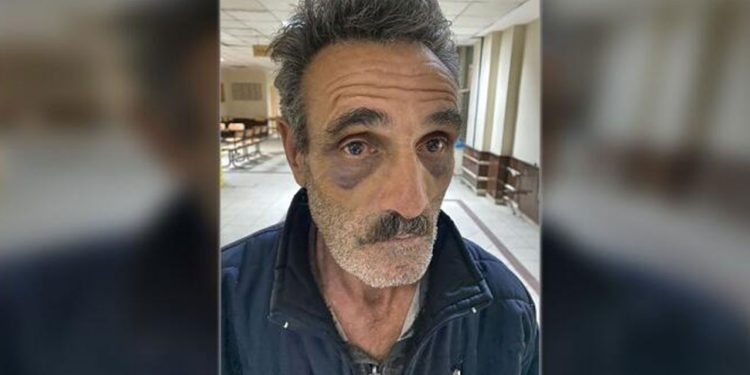 Suruç’ta gözaltına alınan Bozan Demir’e işkence iddiası