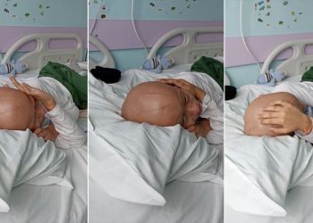 Yusuf Kerim’in doktoru: Tüm kanser hastalarının anneleri başlarında, bir tek bu çocuğun annesi yok…