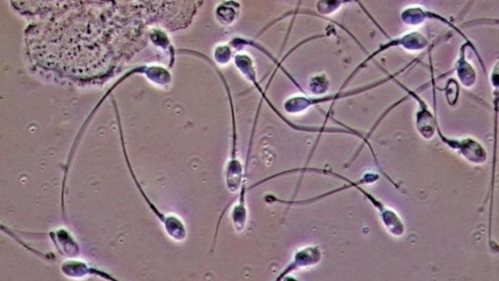 Hollanda yargısından sperm donörüne yasak:  550'den fazla çocuğun babası olmuş