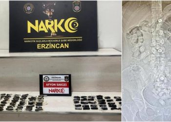 İranlı iki kadının midelerinden 693,3 gram Afyon sakızı çıktı