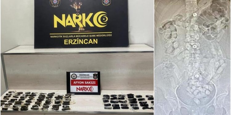 İranlı iki kadının midelerinden 693,3 gram Afyon sakızı çıktı